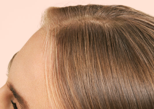 THINNING HAIR IN WOMEN? CAUSES & BEST PREVENTION